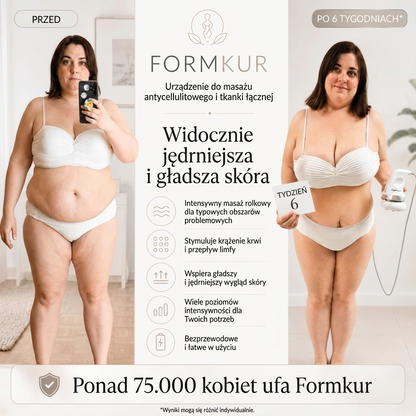 Shape Treatment – masajeador anticelulítico para abdomen, piernas y glúteos
