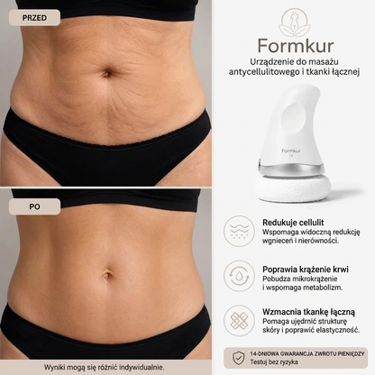 Shape Treatment – masajeador anticelulítico para abdomen, piernas y glúteos