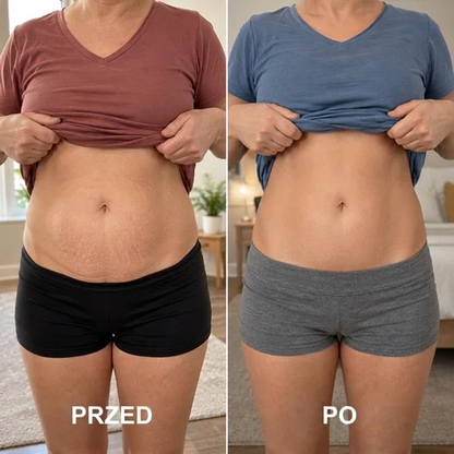 Shape Treatment – masajeador anticelulítico para abdomen, piernas y glúteos